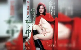 Thumbnail of related posts 114